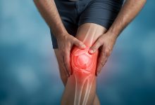 Lesão de menisco sempre precisa de cirurgia