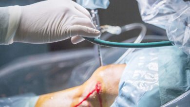 Sutura do menisco quando ela é indicada